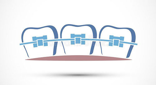 Orthodontic assessment waiting times in Galway not acceptable